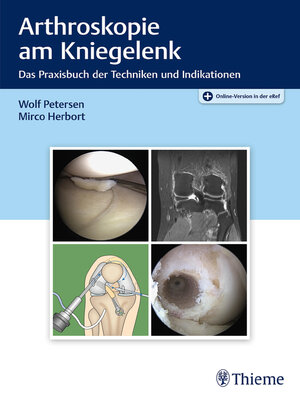 cover image of Arthroskopie am Kniegelenk